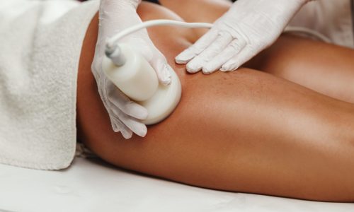 Shot of an unrecognizable woman getting anti cellulite massage at the beauty salon. She have an ultrasound cavitacion treatment to fat reduction.